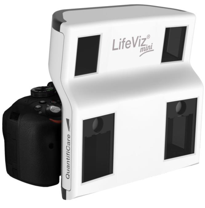 Equipo LifeViz Mini